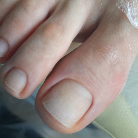 Педикюр гигиенический / Pedichiură igienică — Center Nails